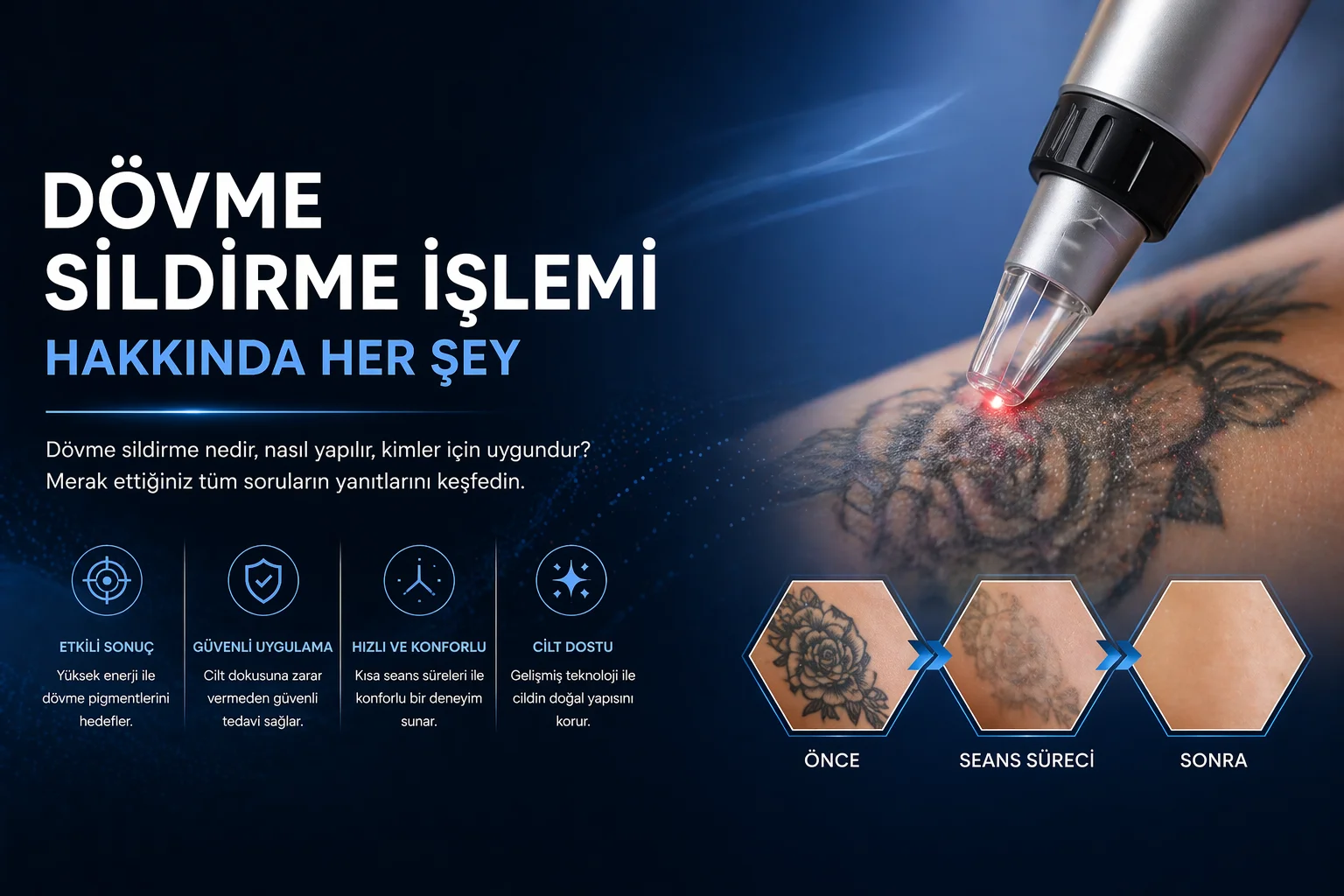 dovme sildirme islemi hakkinda her sey